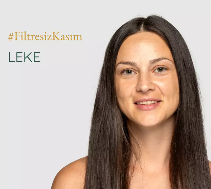 filtresiz kasım, leke